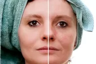 Deciles chau a esas manchas feas de tu cara