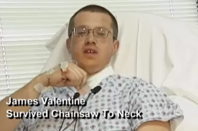 Hombre sobrevive milagrosamente luego de enterrar una sierra eléctrica en su cuello