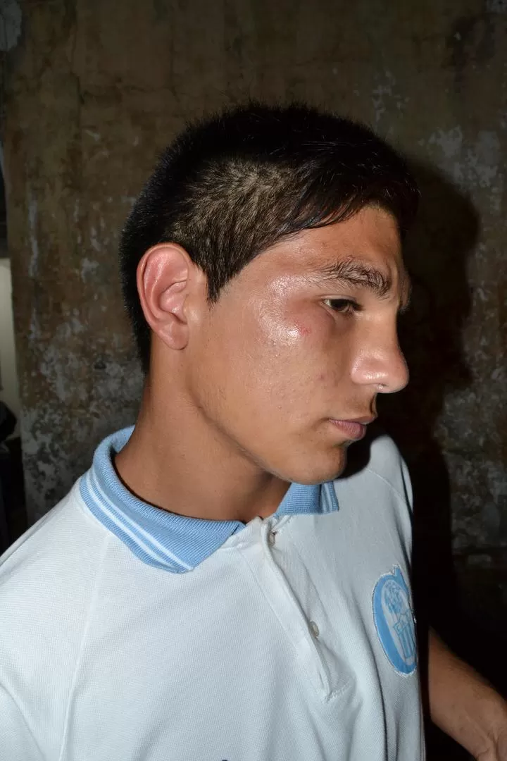 LA PRUEBA. Nicolás Lezcano muestra la lesión que sufrió al ser golpeado por un simpatizante de Concepción FC. 