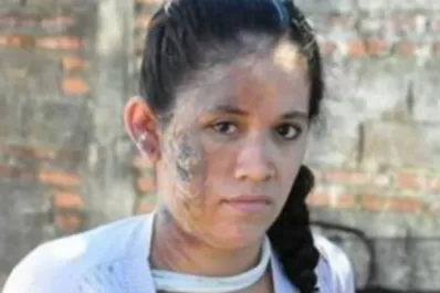 La joven quemada con agua hirviendo dijo que inventó el ataque de los motochorros por miedo