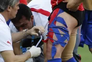 La impactante imagen de la pierna de Gary Medel