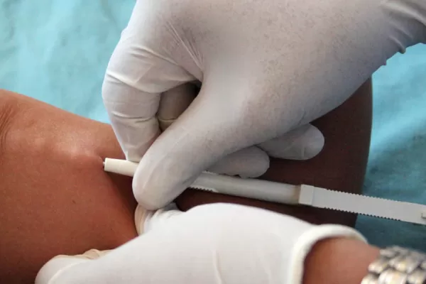Adolescentes jujeñas podrán acceder en agosto al anticonceptivo por implante subdérmico