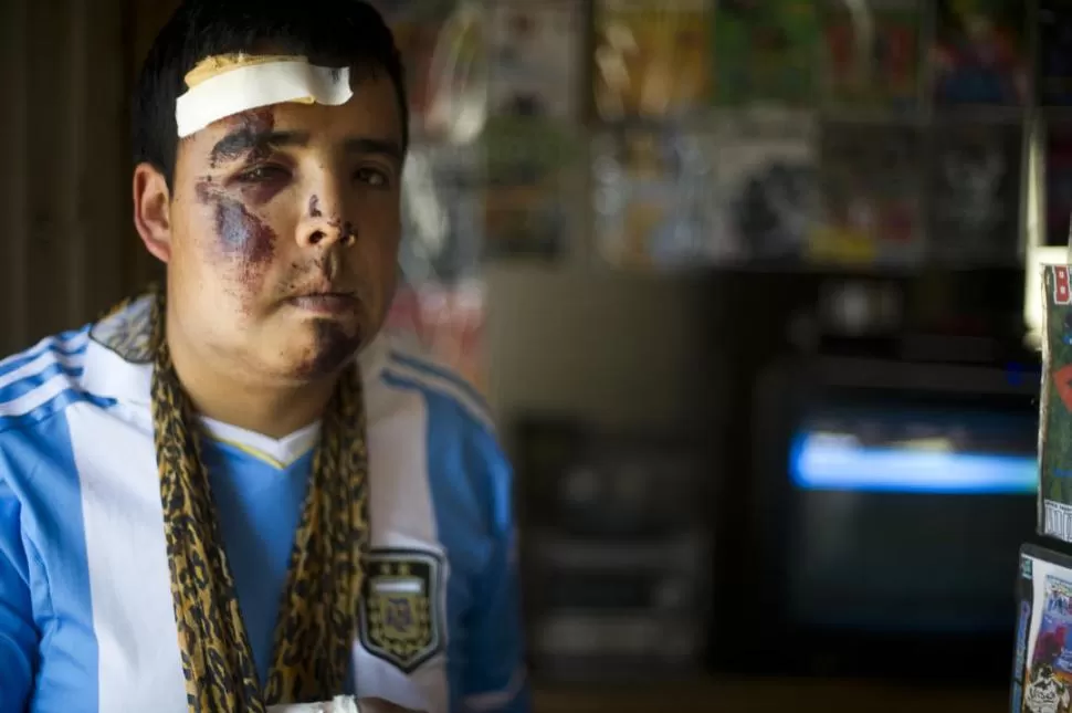 DOLORIDO. Jiménez sufrió fracturas y sangra constantemente por la nariz. LA GACETA / FOTO DE JORGE OLMOS SGROSSO