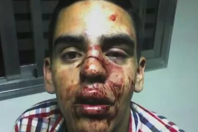 Denunció que tres policías lo golpearon en un boliche del microcentro