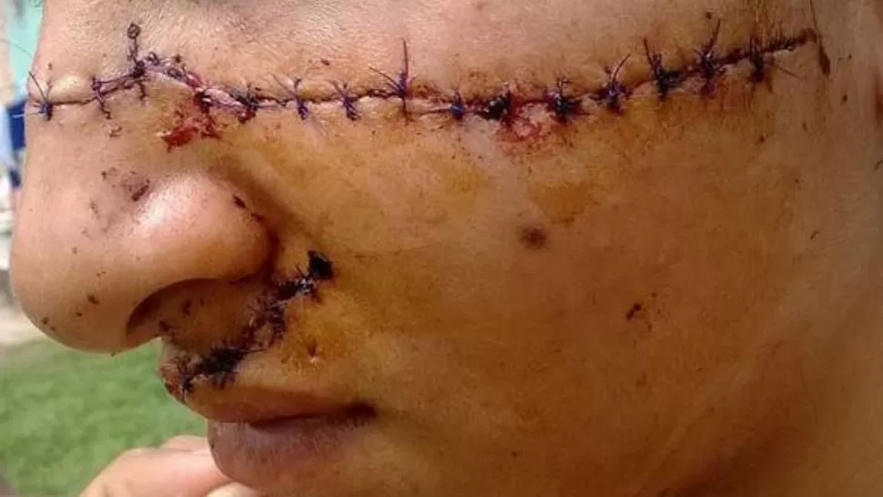 ASÍ QUEDÓ. La cara de la adolescente golpeada. IMAGEN DE INFOBAE.COM