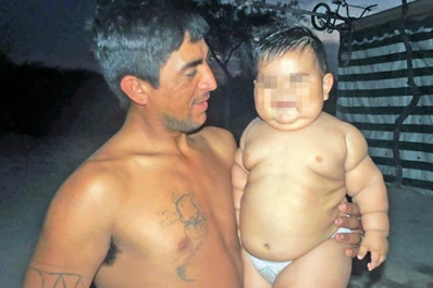 Un bebé de nueve meses pesa 20 kilos y su familia pide ayuda