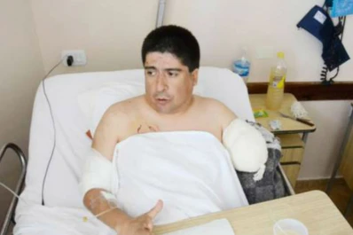 Un rottweiler le arrancó el brazo a su dueño