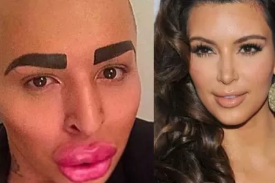 Un joven gastó U$S 150.000 para parecerse a Kim Kardashian