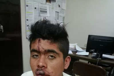 Investigan una supuesta golpiza de policías