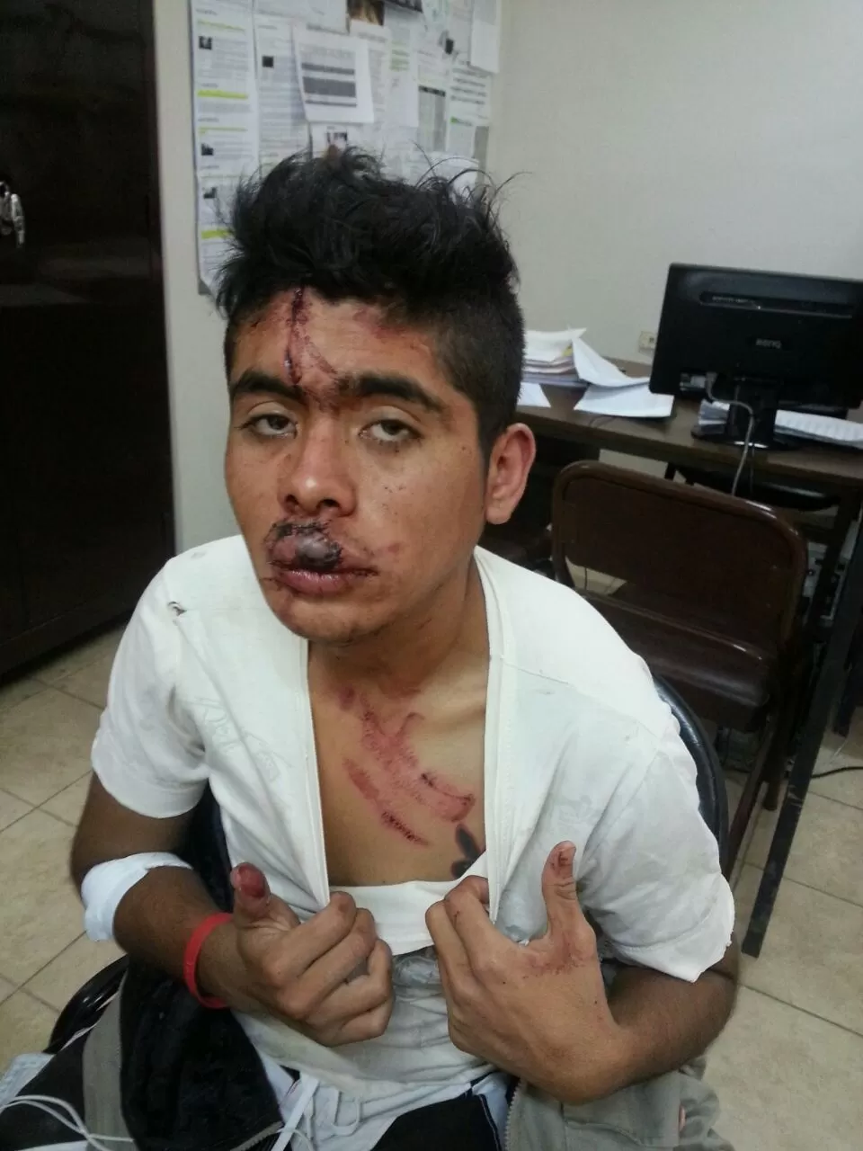 LESIONES. Gastón Díaz quedó con su rostro destruido y declaró que fue producto de las patadas de los policías.  