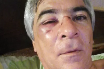 Un árbitro tucumano recibió una trompada en la cara, en pleno partido