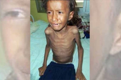 Un niño qom de siete años murió por desnutrición y tuberculosis