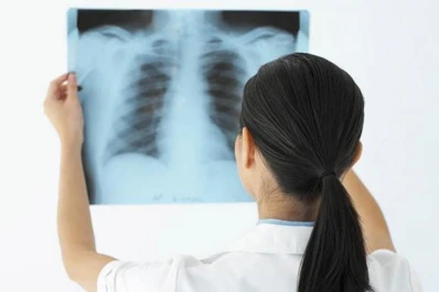 La enfermedad de los labios azules es fácil de detectar