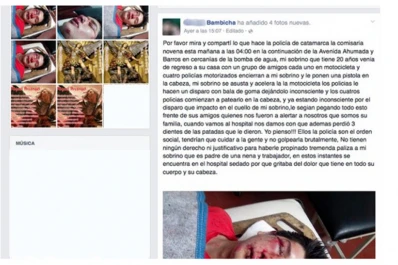 Investigan en Catamarca si policías desfiguraron a un chico a golpes