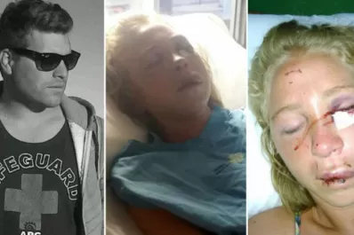 Denunció que su novio la golpeó hasta dejarla inconsciente