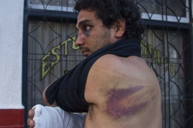 Un joven catamarqueño acusa a la policía de haberlo patoteado
