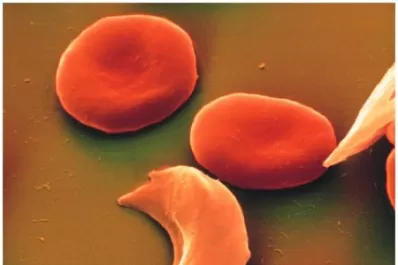 “Se tarda mucho y es muy caro llegar al diagnóstico certero”