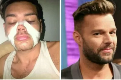 Un ex participante de 'Cuestión de Peso' se operó para parecerse a Ricky Martin