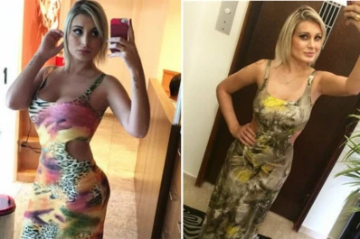 Así quedó Andressa Urach, Miss Bumbum 2012, tras una cirugía casi mortal