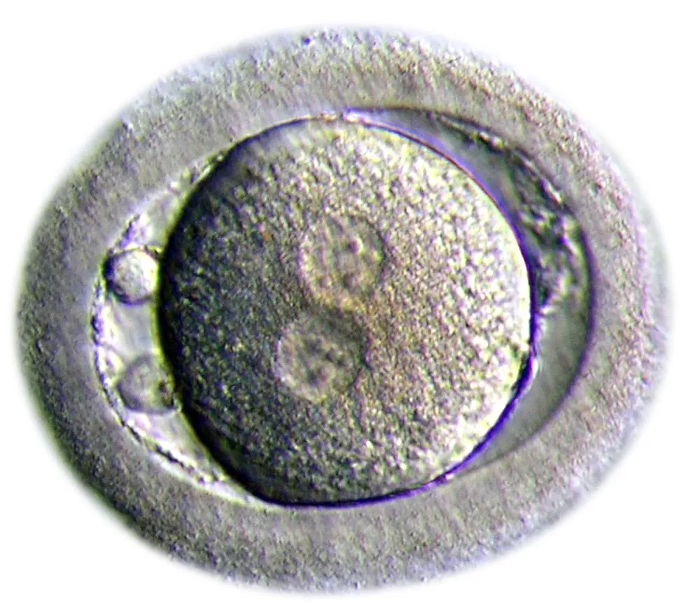 La imagen muestra un óvulo que, después de ser descongelado, es sometido a una fertilización in vitro. 