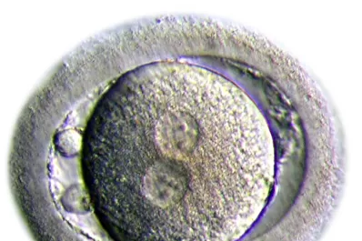 Desafiar el reloj biológico  tiene sus riesgos