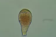 El factor climático potencia el avance