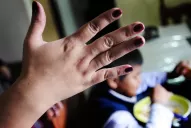 El chirlo y el maltrato entraron a la lista negra