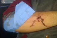 Balearon a un chofer de la línea 12 durante un asalto