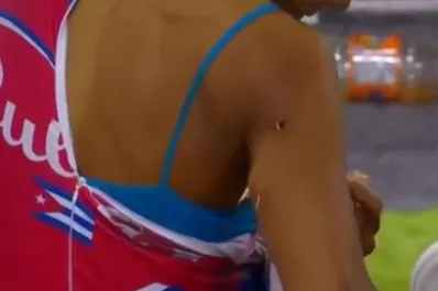 Chocó con su bicicleta y se le incrustó una astilla en el hombro