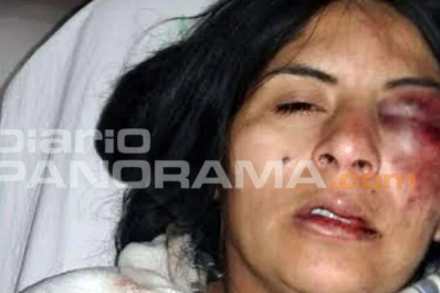 Atacaron a una mujer con una maza y la desfiguraron