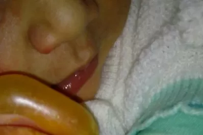 Apenas nacida, le quemaron las manos con un caloventor