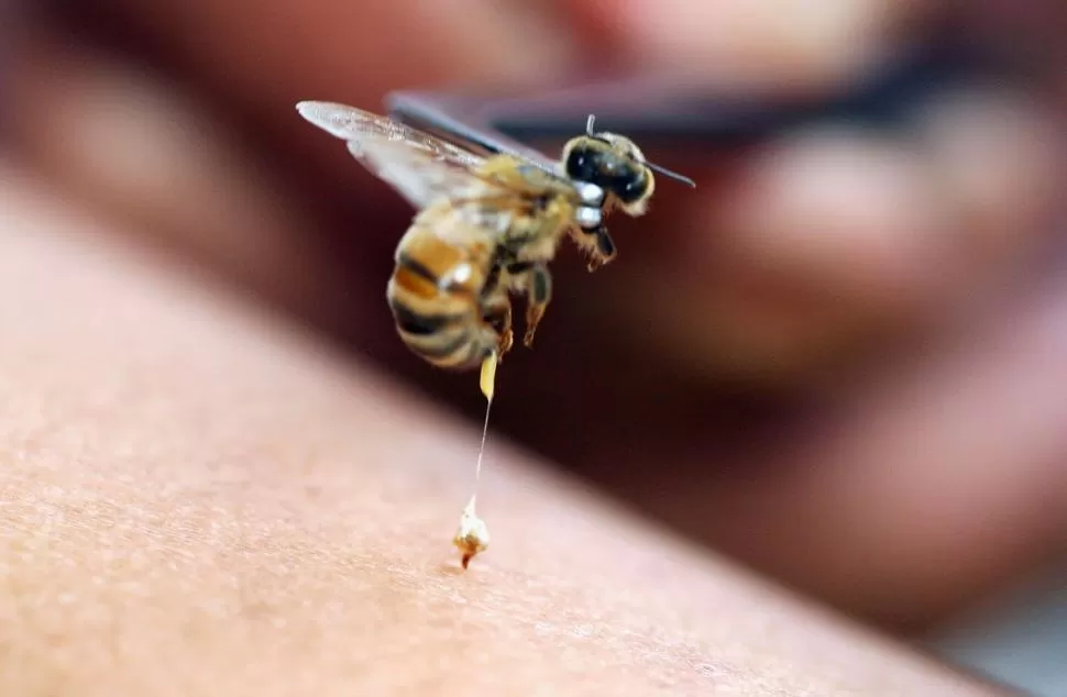 VENENO QUE CURA. Lo que se aplica es la apitoxina, que se extrae de las abejas italianas o africanizadas.  blog.centroestetico2002.es
