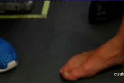 Así le quedó el pie a Messi, que tuvo que viajar descalzo