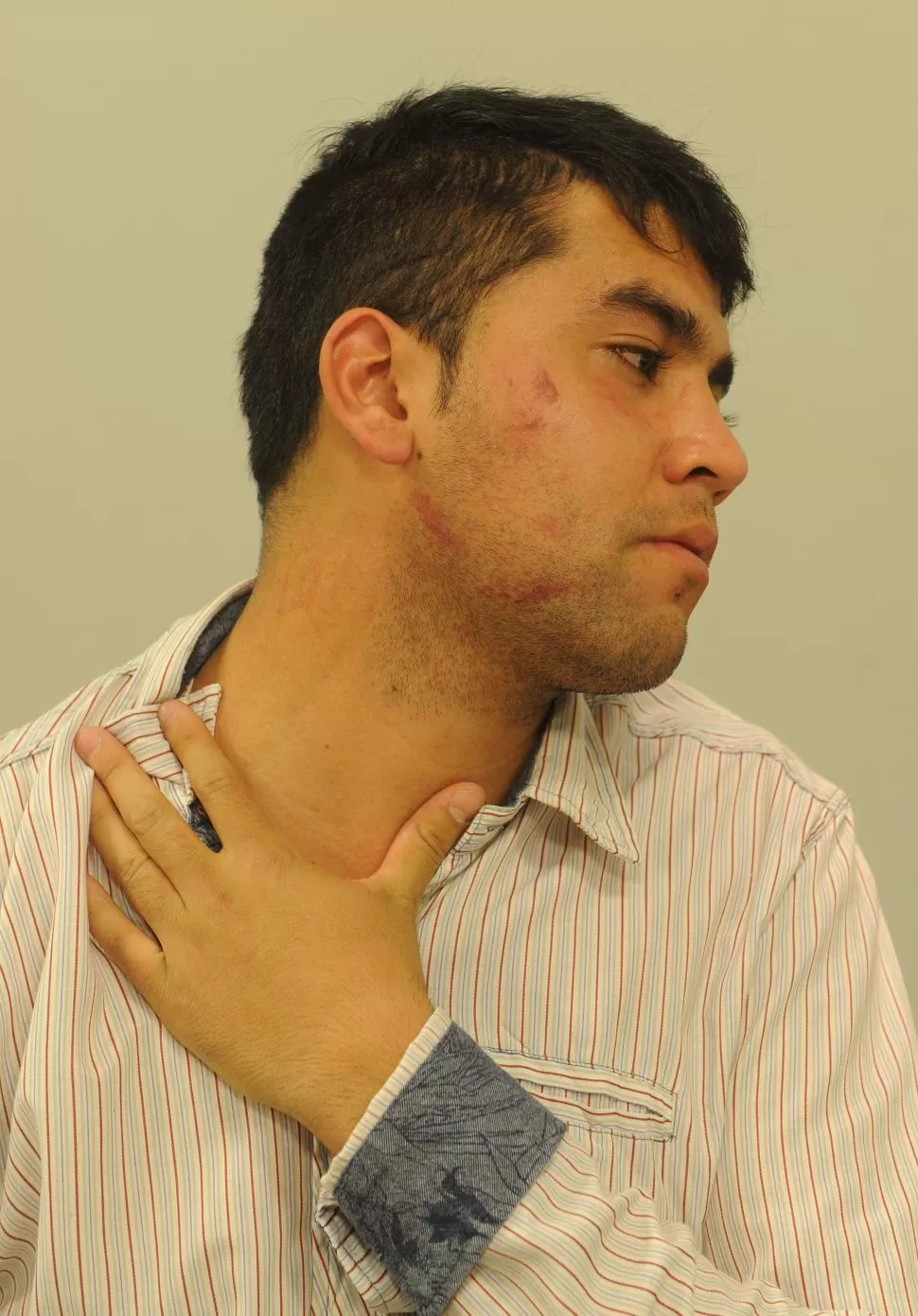 HERIDAS. Jorge Soto sufrió golpes y cortes en la cara, el cuello y el tórax. la gaceta / foto de héctor peralta