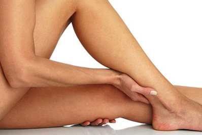 Claves para controlar las várices, un mal que también afecta lo estético