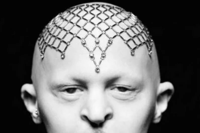 Fascinación en Nueva York por una modelo calva y sin dientes