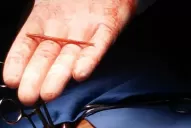 Parece un caso del Doctor House, dijo el médico que operó al hombre del palillo en el corazón