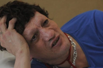 Pity Álvarez reapareció sin cejas y con la cara demacrada