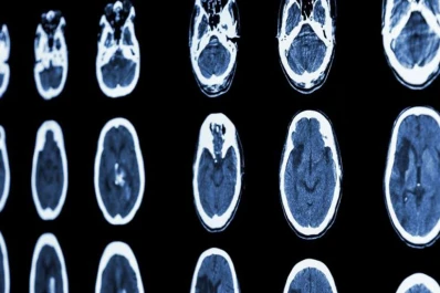 Según un estudio no existen cerebros masculinos o femeninos