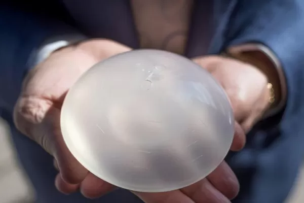 Los implantes de senos viven una reconstrucción
