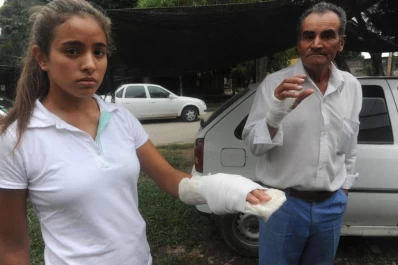 Le martilló el rostro y le mordió la mano en un intento de robo
