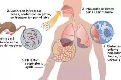 ¿Qué es, cómo se transmite y cómo se detecta el hantavirus?