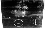 Esperaban dos bebés, nació uno y el Siprosa dice que fue un error