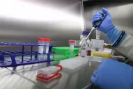 El virus Hanta, entre los 10 más peligrosos del mundo