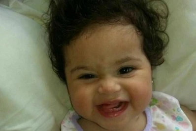 La siamesa que sobrevivió a la separación está mejor y ya toma leche