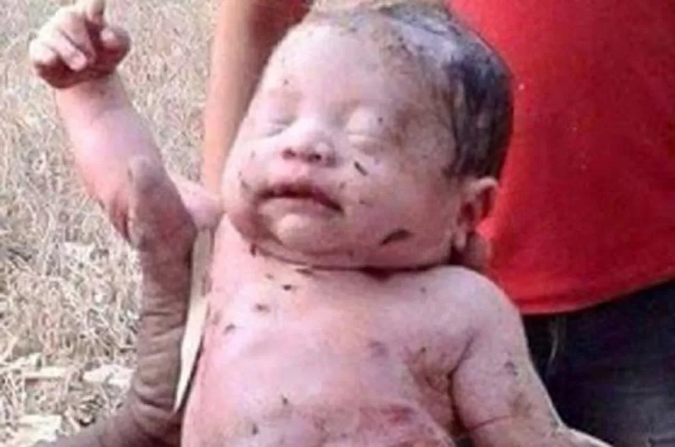 TAILANDIA. El bebé que recibió 14 puñaldas y fue enterrado vivo. FOTO TOMADA DE MINUTOUNO.