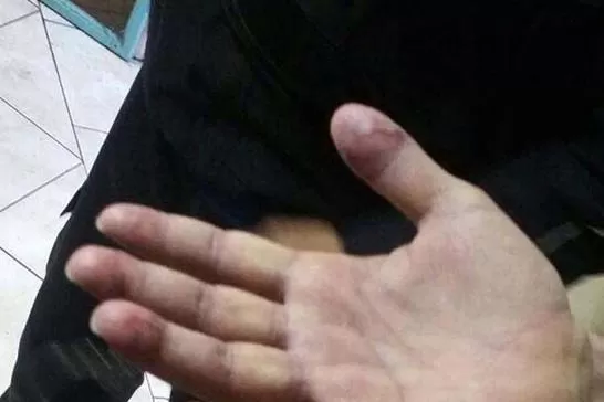 LA PRUEBA. Las manos de Perez Corradi evidencia el tratamiento para el borrado de las huellas de sus dedos. TELAM