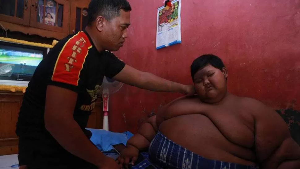 El niño más obeso del mundo tiene 10 años y pesa 192 kilos