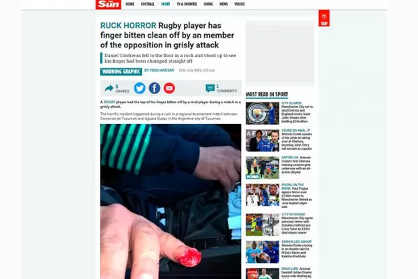 El caso del rugbier tucumano al que le mordieron un dedo llegó a los diarios ingleses