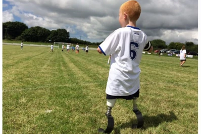 Emotivo: un niño sin piernas ni brazos cumplió su sueño de jugar al fútbol